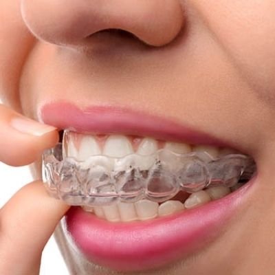 Placas de relajación