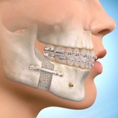 Cirujia maxilofacial en Rosario Santa Fe