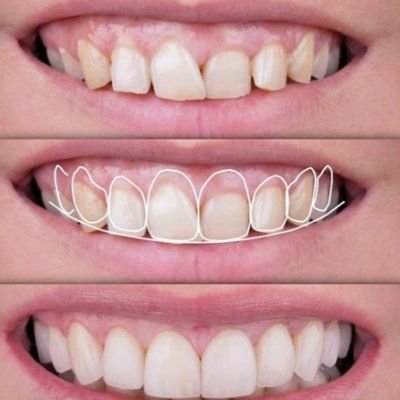 Estética restauradora